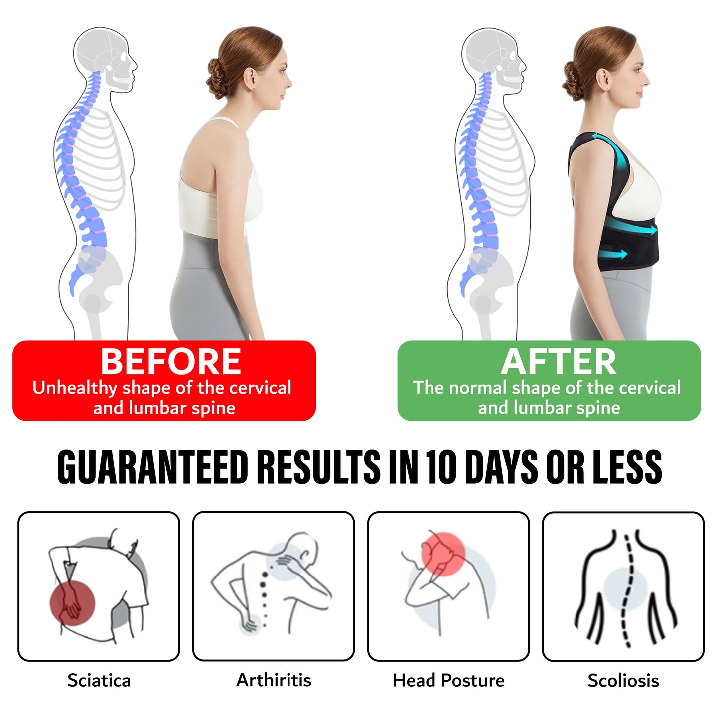 Premium Posture Corrector Brace